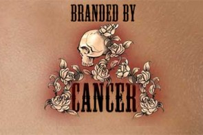 Branded by Cancer documentary image